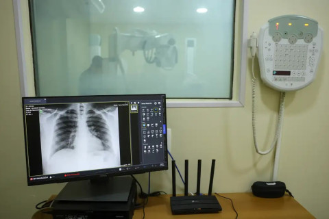 Brasil tem aumento de hospitalizações por Influenza A, alerta Fiocruz