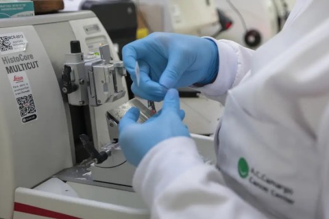 SUS inclui nova terapia para pacientes adultos com leucemia mieloide