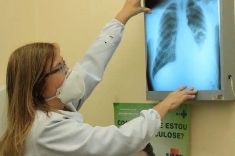 Tuberculose: em 2024 foram 85 mil casos e 6 mil mortes em todo país