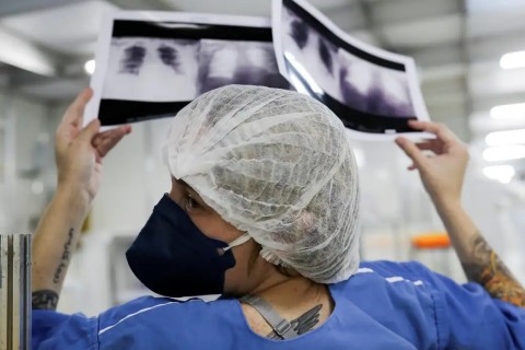 Brasil deve ter 781 mil novos casos de câncer por ano até 2028