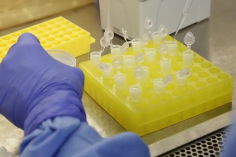 SP confirma segundo caso importado de sarampo